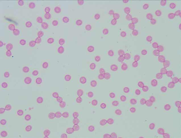 人血细胞